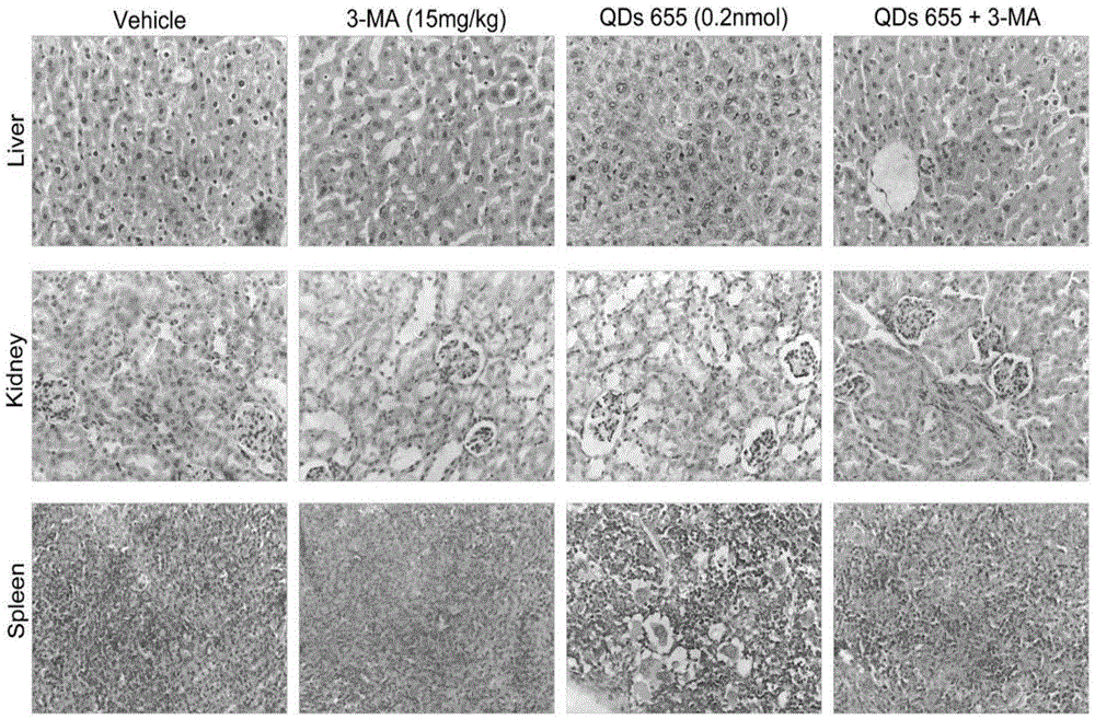 Lung cancer targeted low-toxicity quantum dot preparation