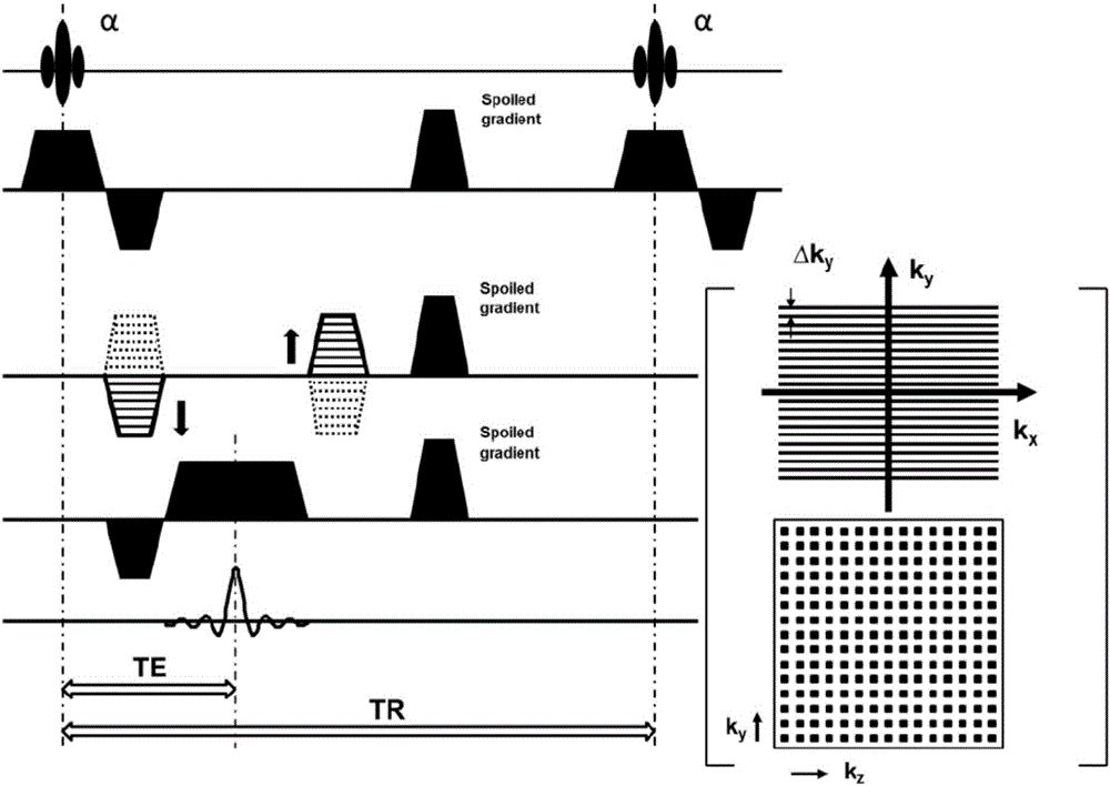 Abdominal organ dynamic contrast enhanced magnetic resonance imaging method based on compressed sensing