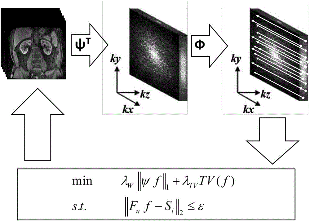 Abdominal organ dynamic contrast enhanced magnetic resonance imaging method based on compressed sensing