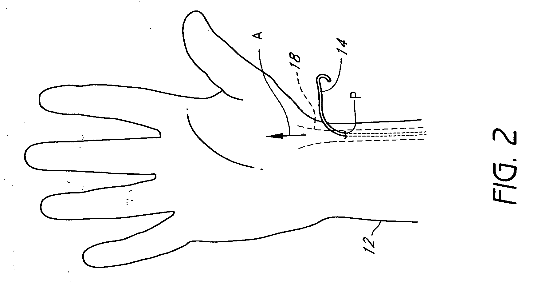 Cardiac output measurement devices and methods