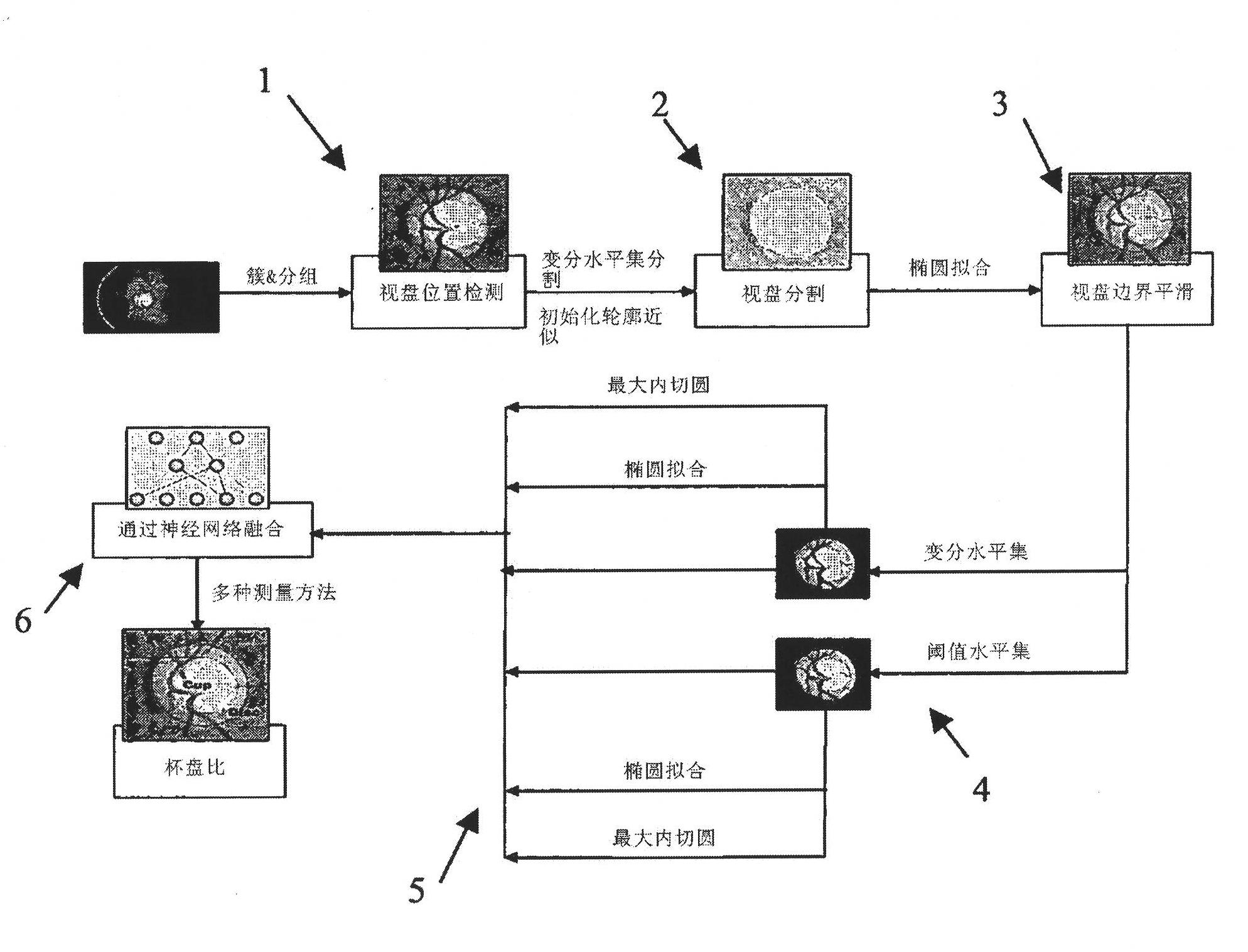 Automatic cup-to-disc ratio measurement system