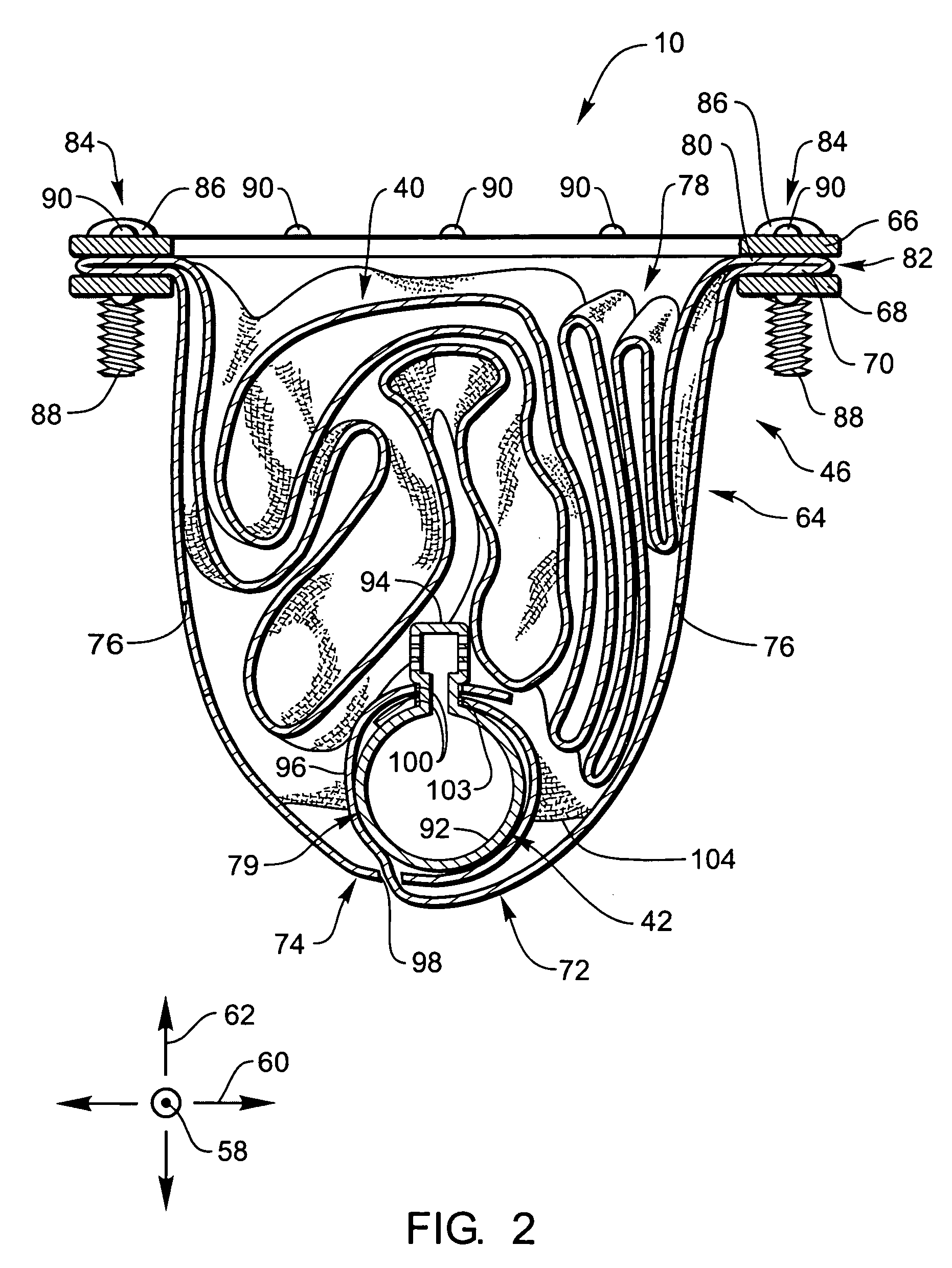 Flexible housing for an airbag module