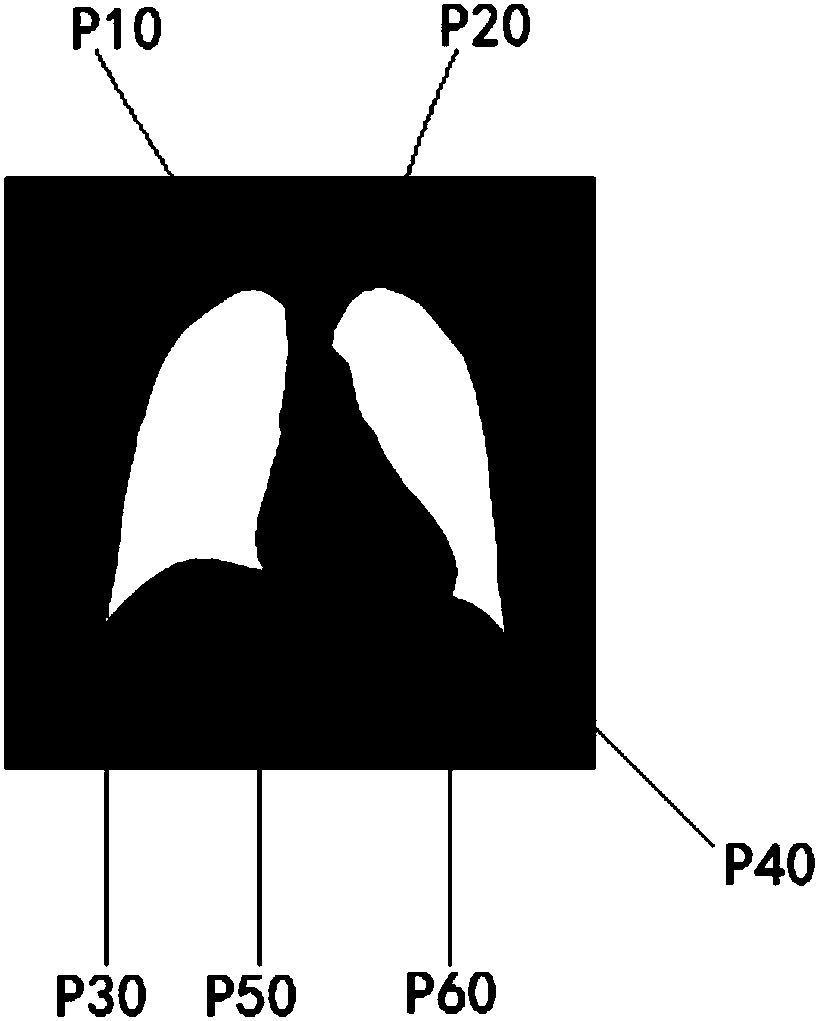 Method for cardio-thoracic proportion calculation of medical image