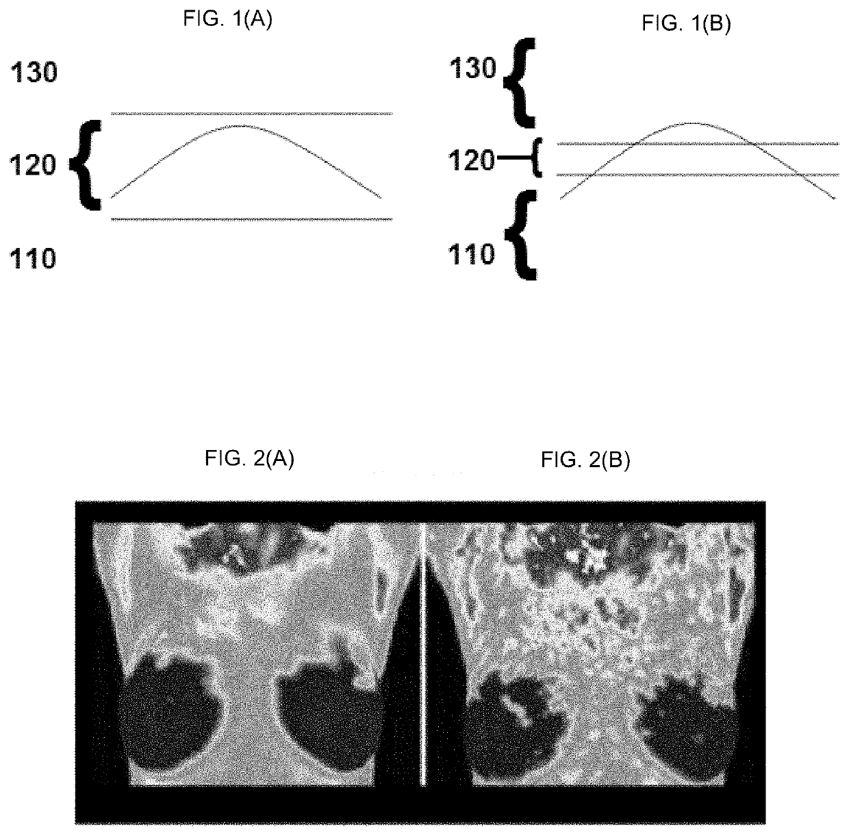 Garment for reducing hot flushes or relieving associated symptoms