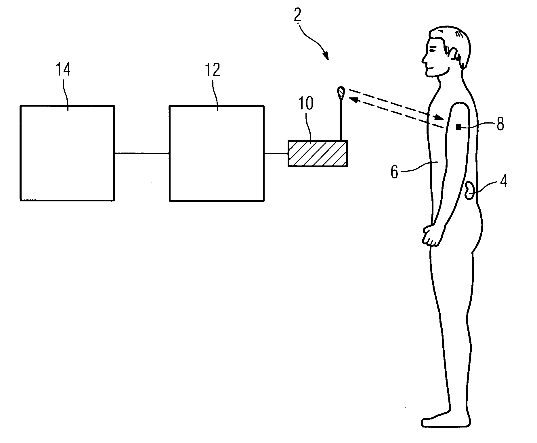 Method and system for identification of a medical implant