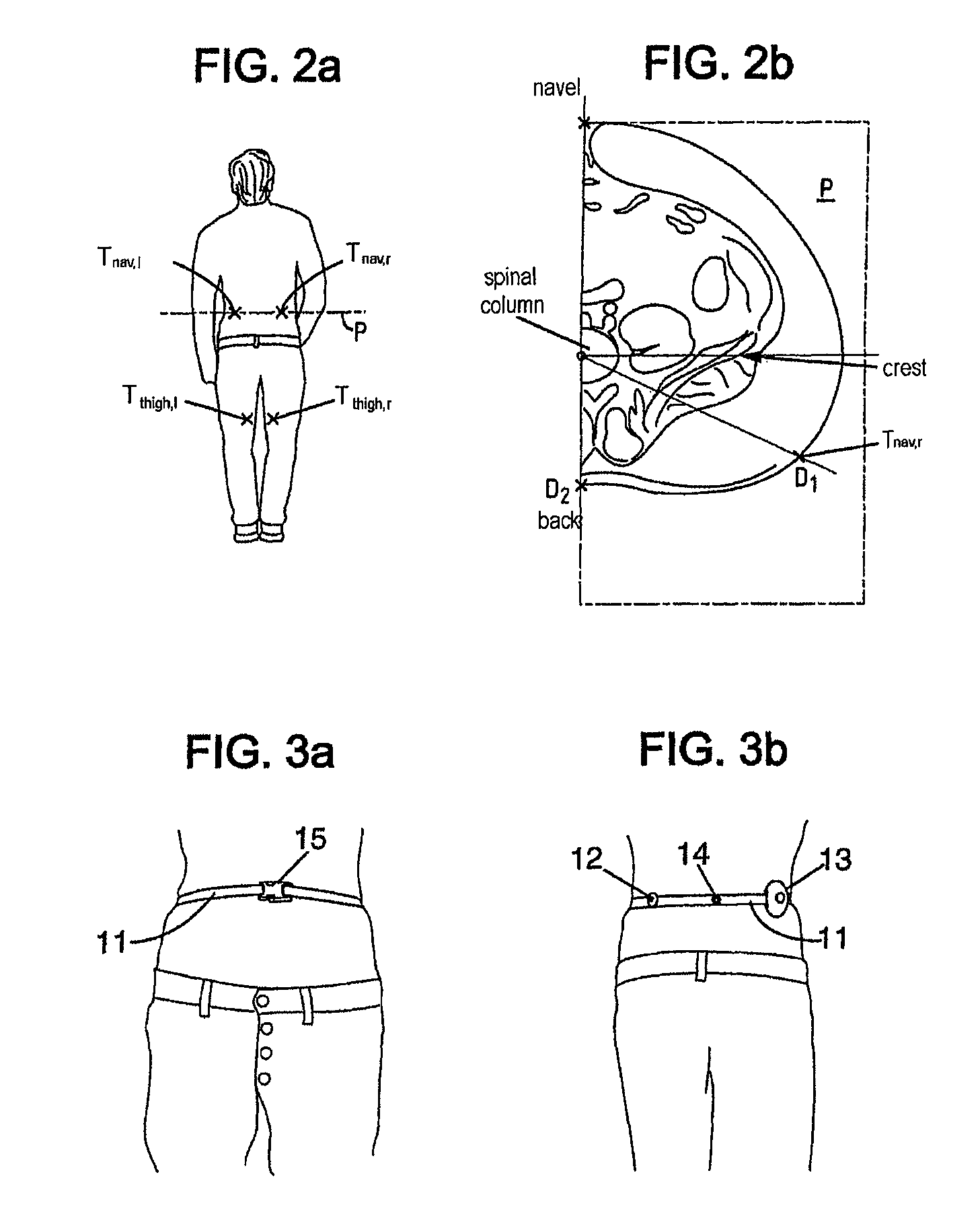 Method and system for determining total body fat, and method and system for determining body composition