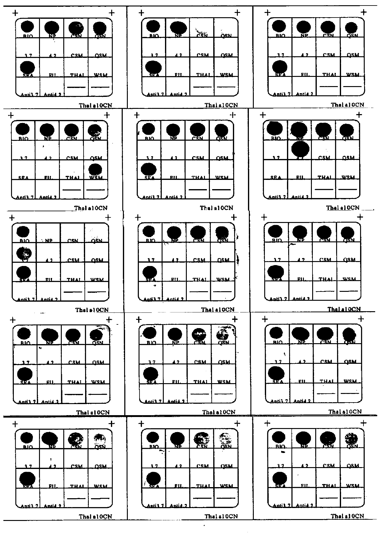 Nucleic acid composition for detecting alpha-thalassemia as well as gene chip, kit and application thereof