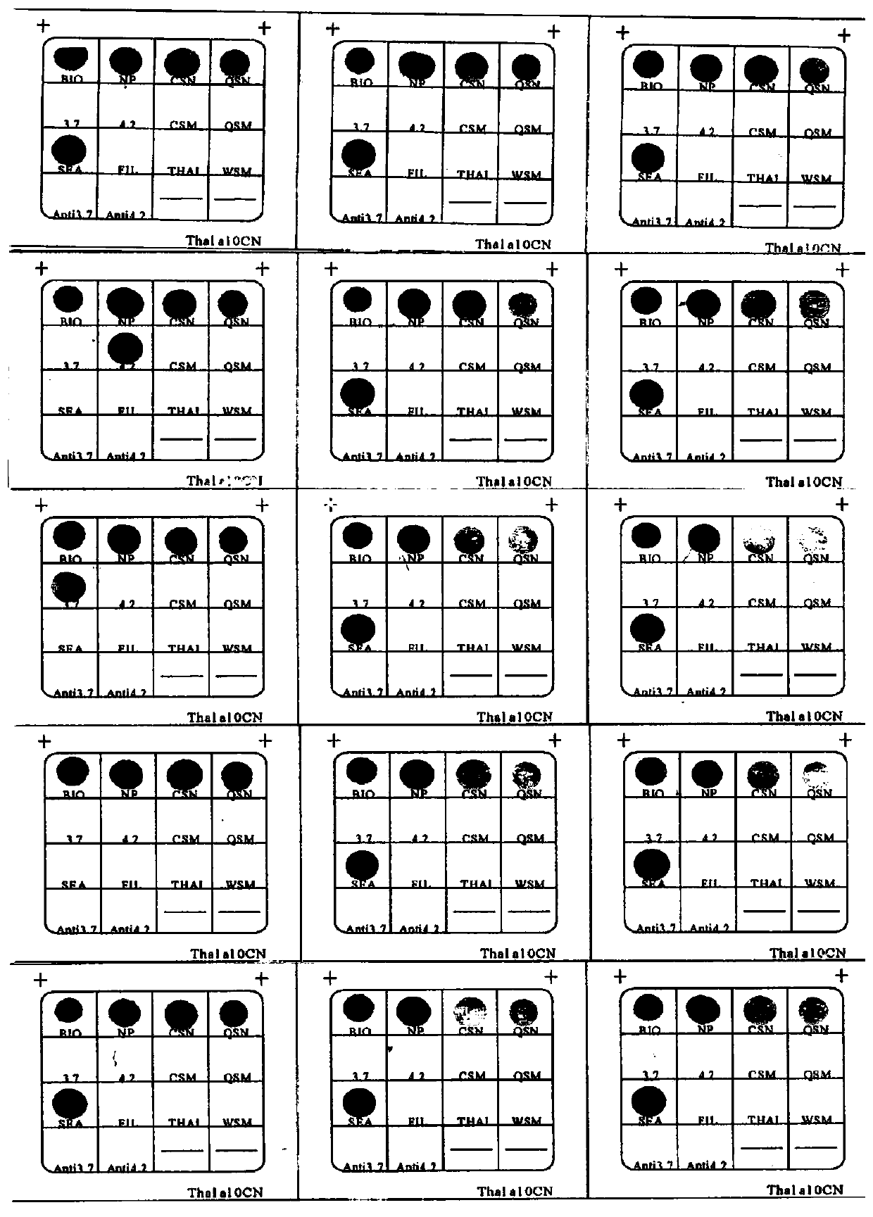 Nucleic acid composition for detecting alpha-thalassemia as well as gene chip, kit and application thereof