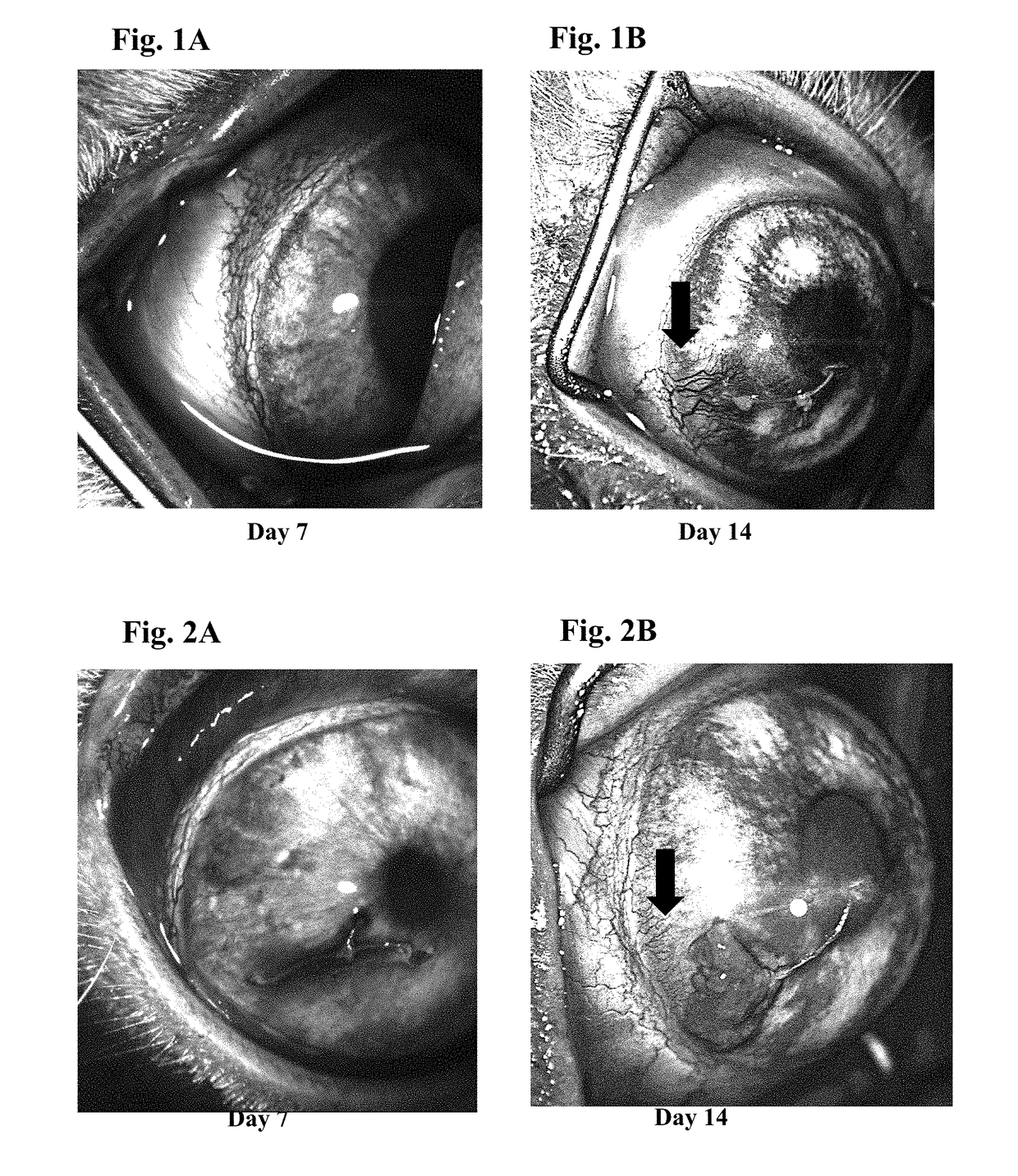 Ophthalmic formulations of tyrosine kinase inhibitors, methods of use thereof, and preparation methods thereof