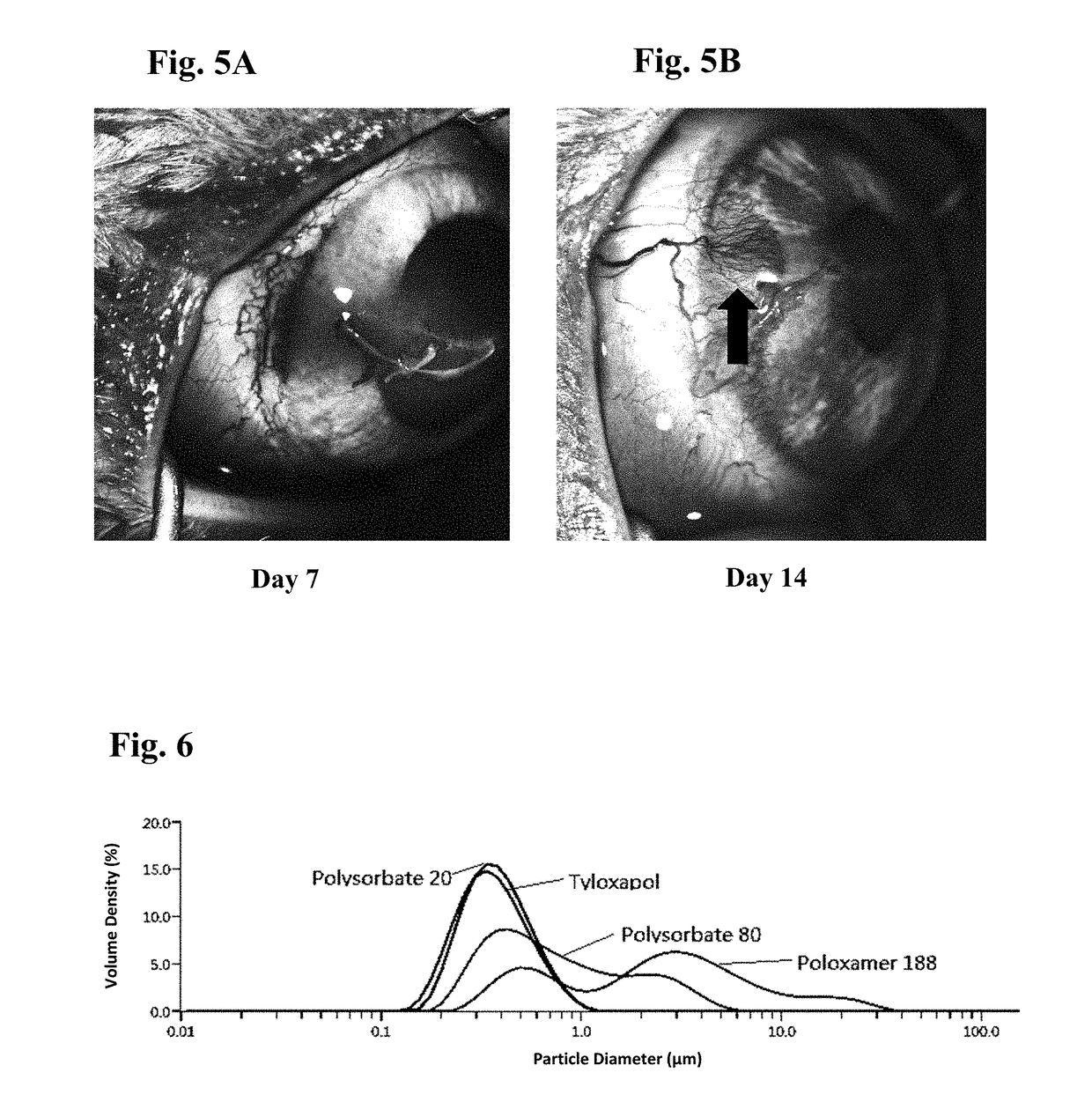 Ophthalmic formulations of tyrosine kinase inhibitors, methods of use thereof, and preparation methods thereof