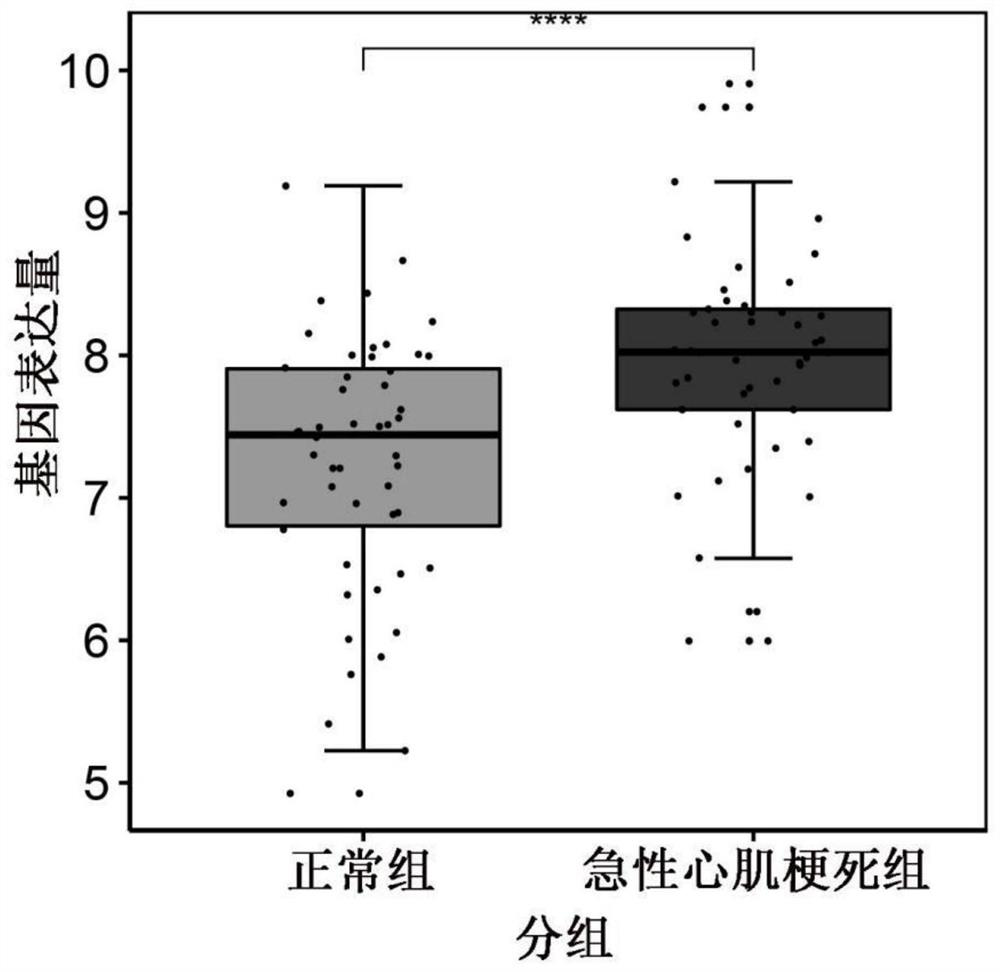 Myocardial infarction differential expression gene and application thereof