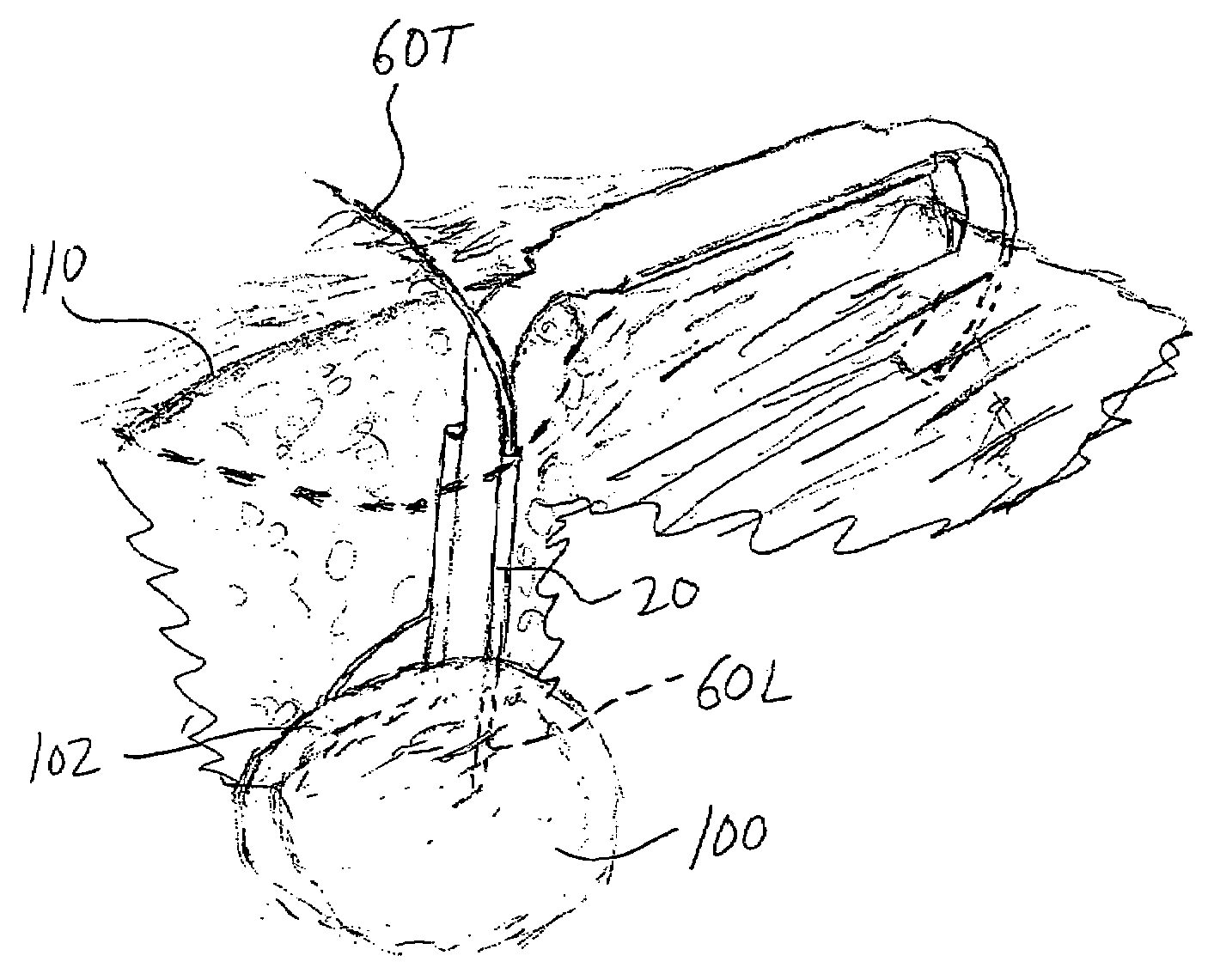 Surgical retractor with attachment