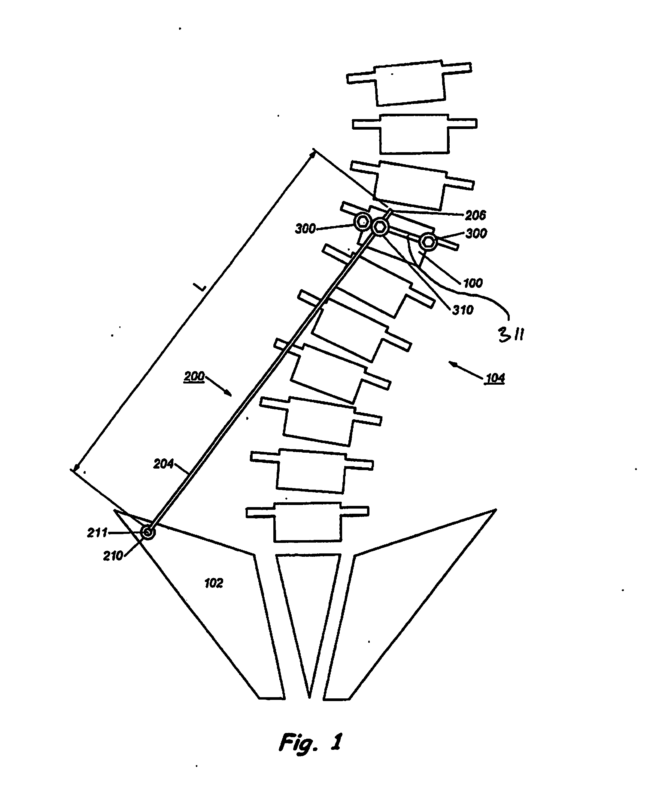 Device and Method for Treatment of Spinal Deformity