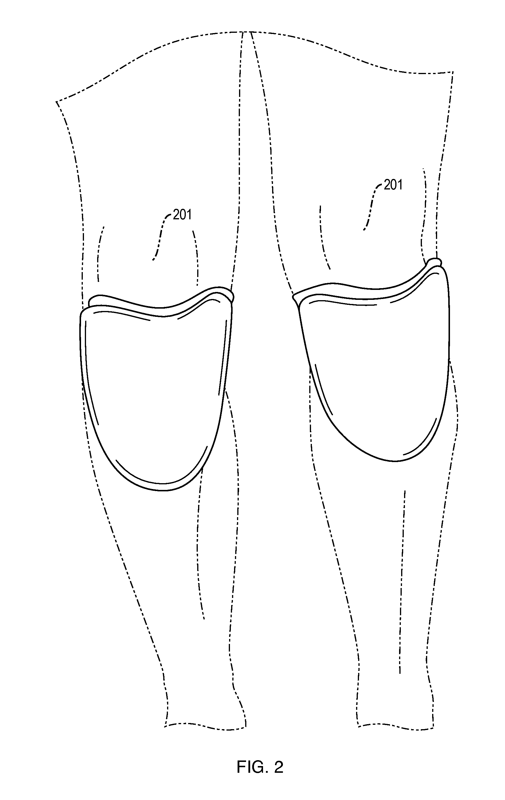 Knee support