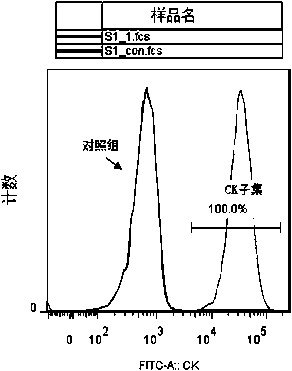 Human cervical adenocarcinoma cell line and preparation method and application thereof