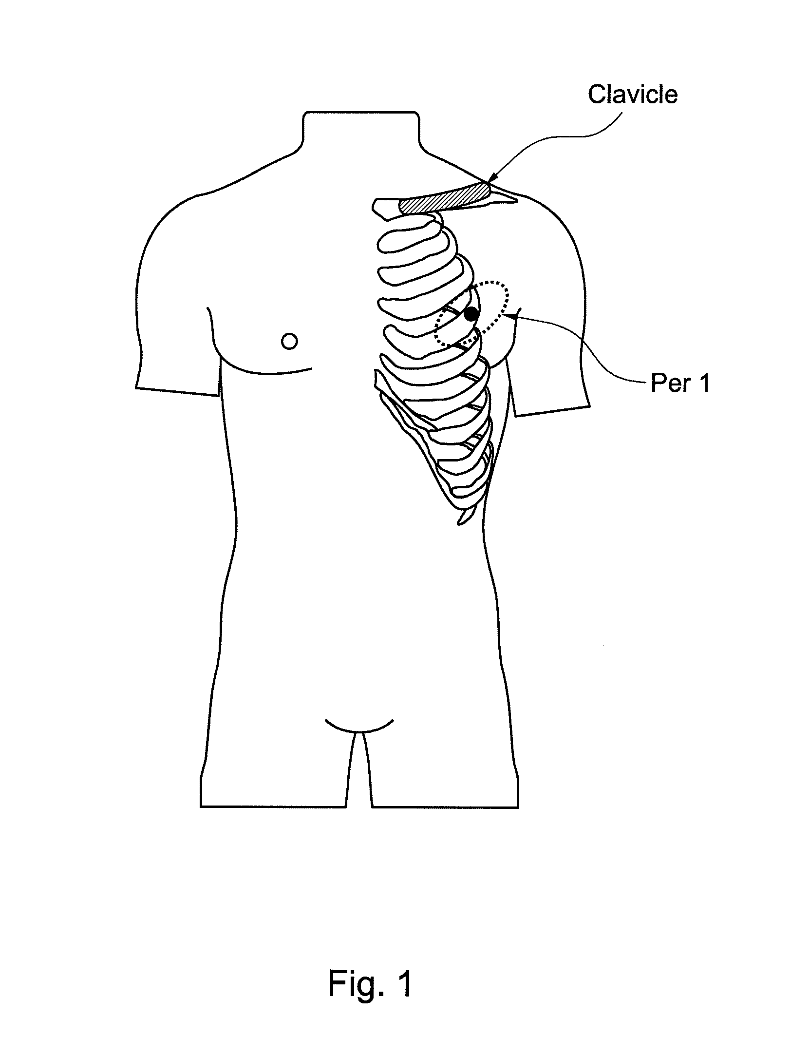 Evaluation of sympathetic tone