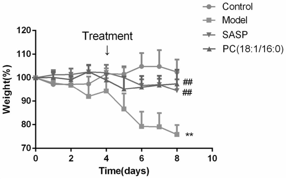 Application of phosphatidylcholine in preparation of medicine for treating ulcerative colitis