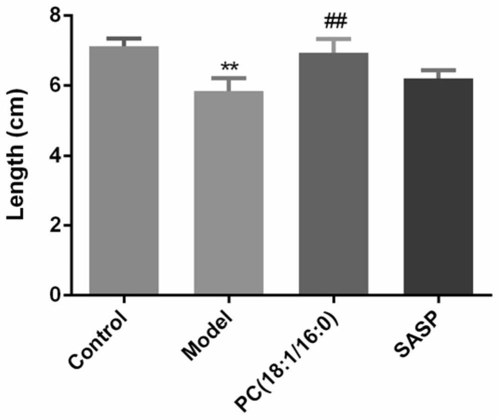 Application of phosphatidylcholine in preparation of medicine for treating ulcerative colitis