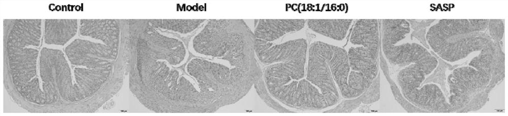 Application of phosphatidylcholine in preparation of medicine for treating ulcerative colitis