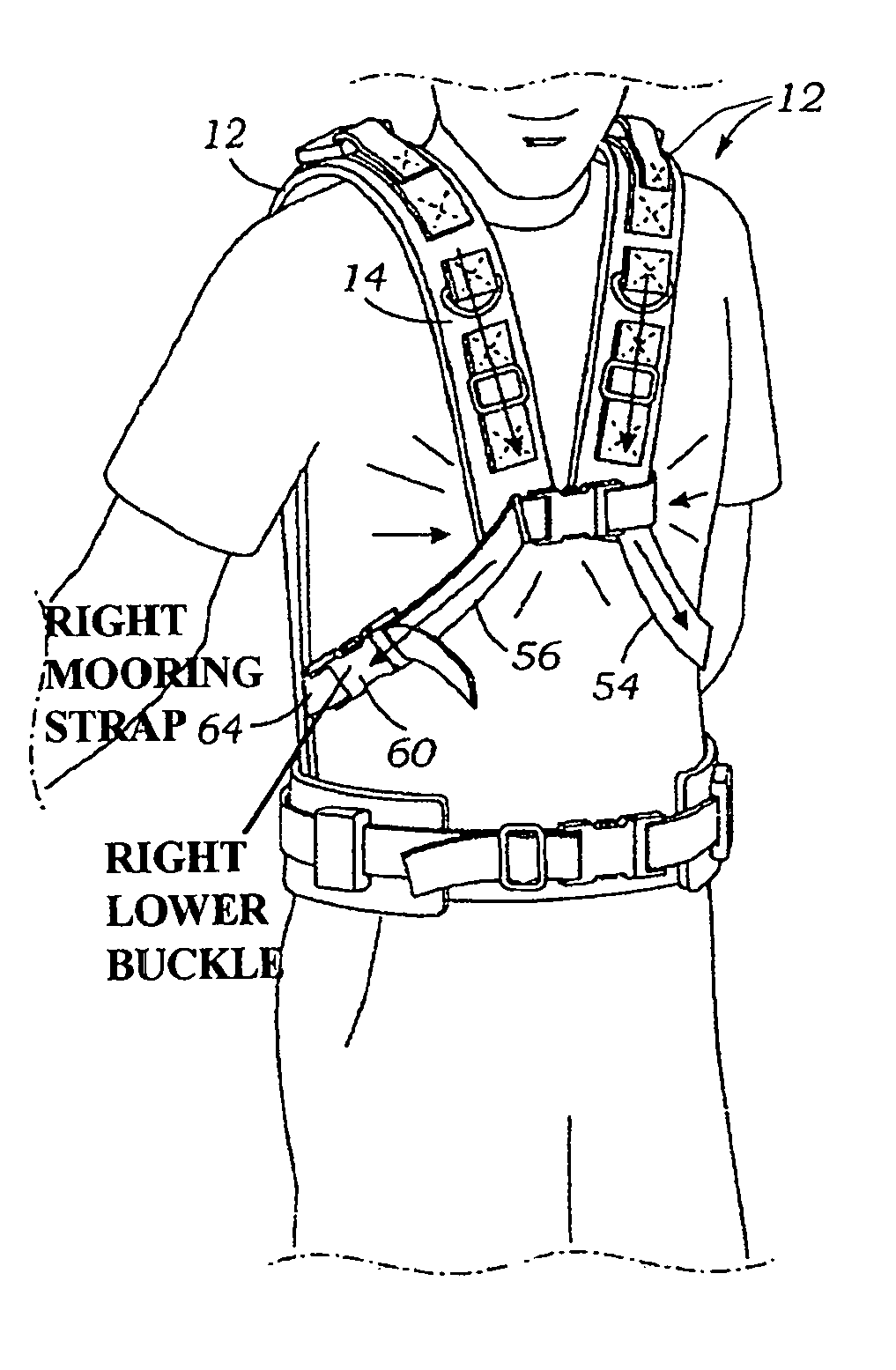 Backpack system