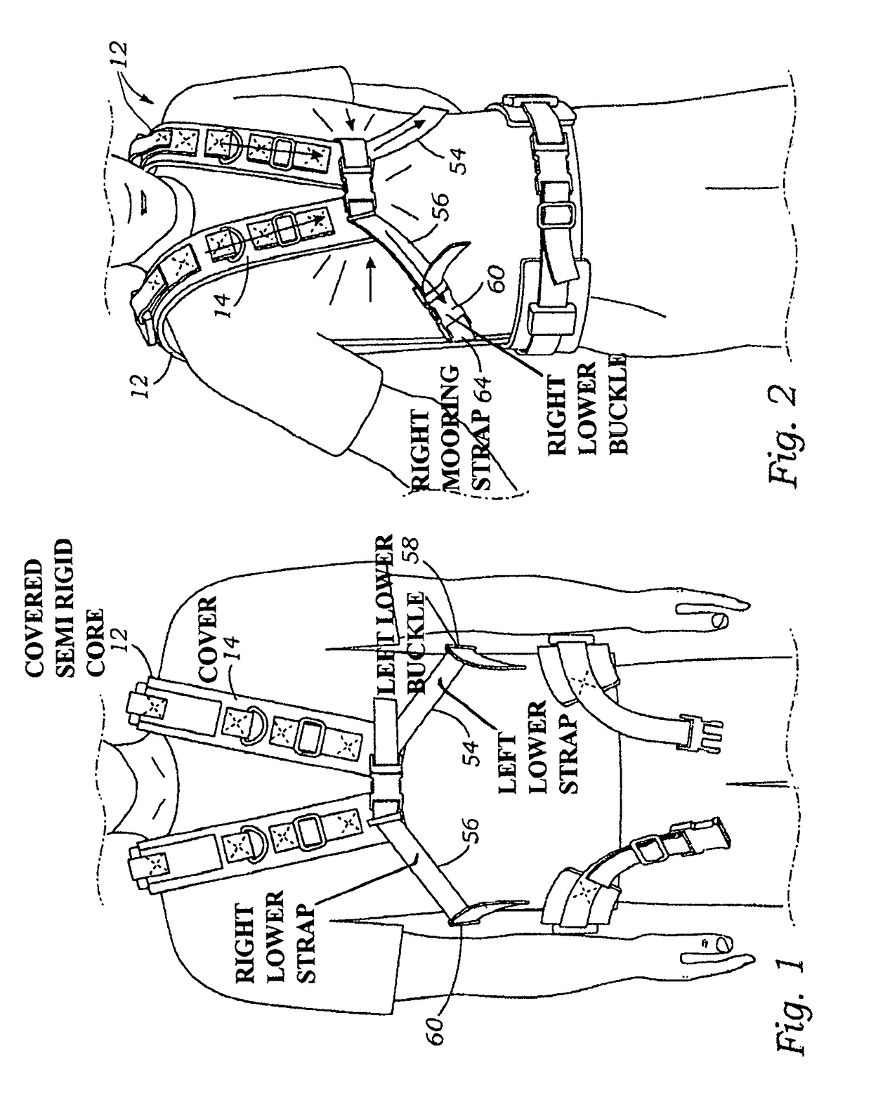 Backpack system