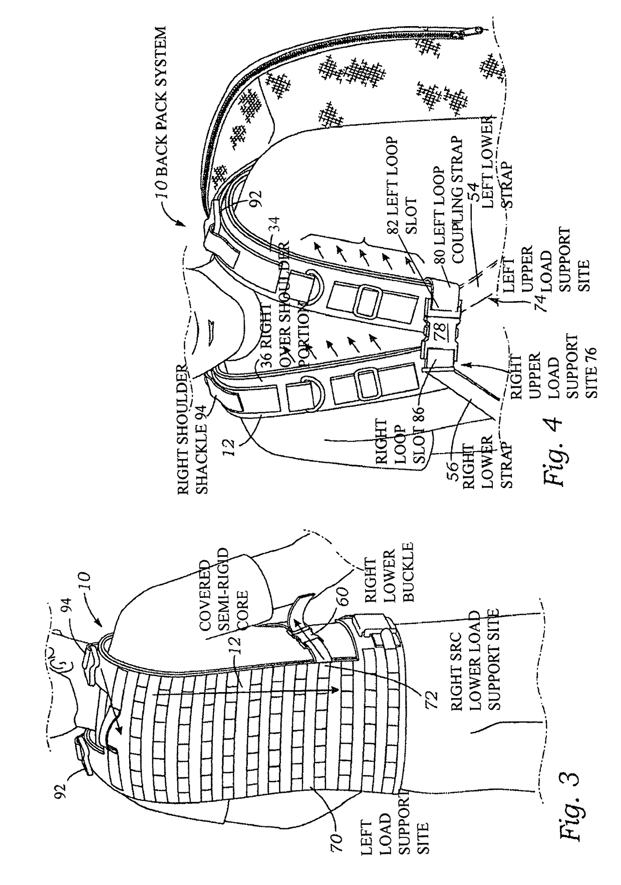 Backpack system