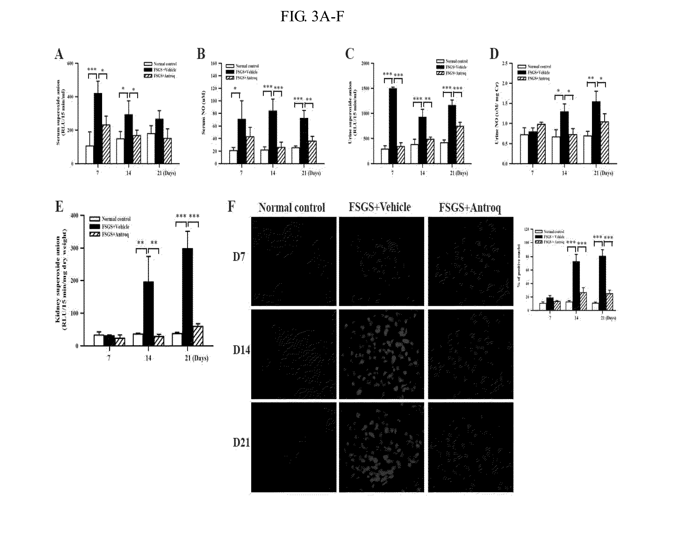 Methods and compositions for treating kidney disorders