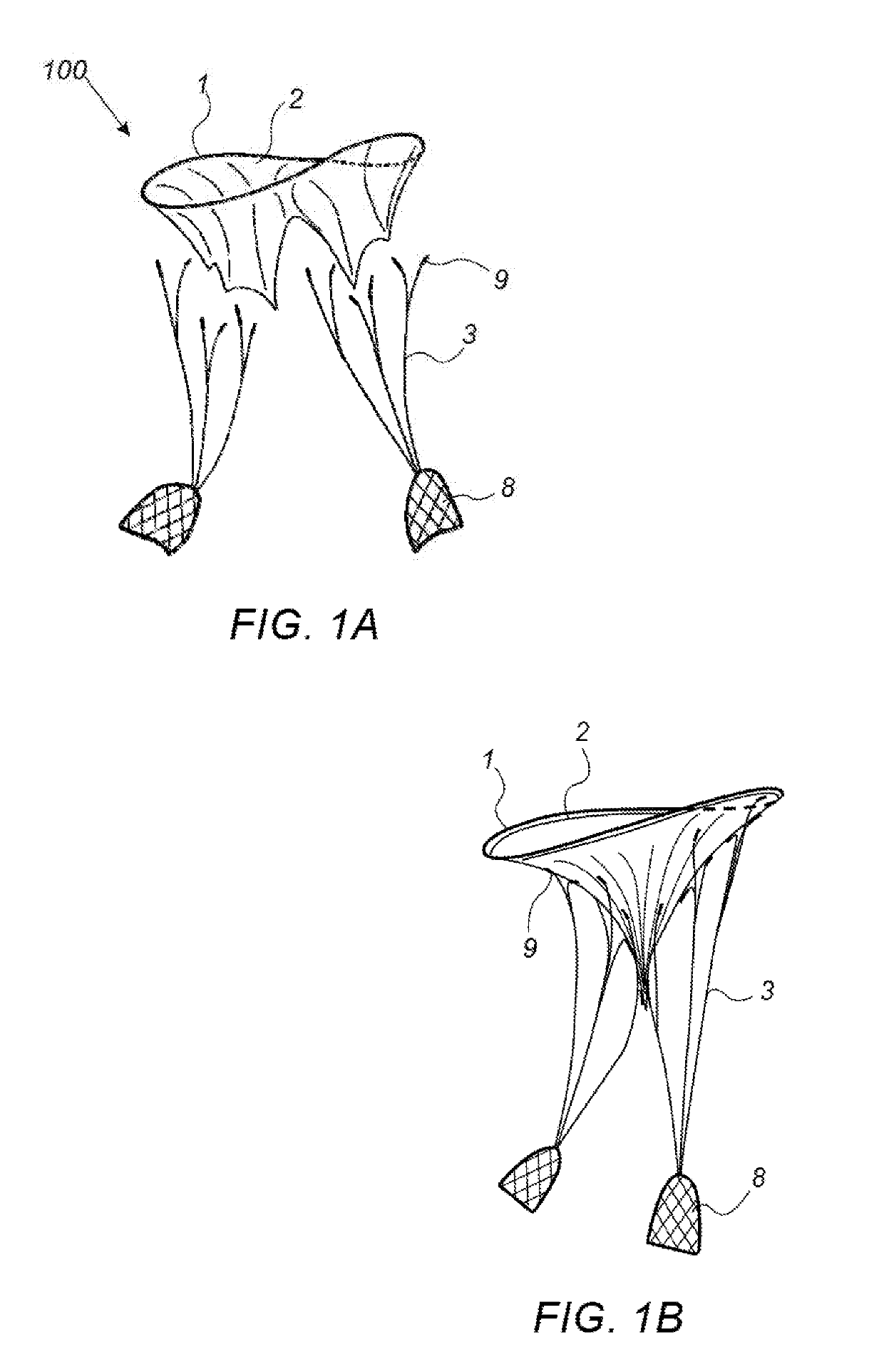 Naturally designed mitral prosthesis