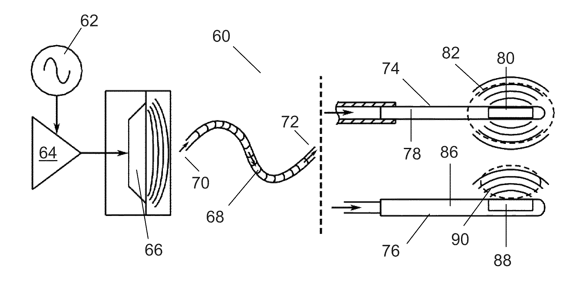 System and method for intracorporeal elastography