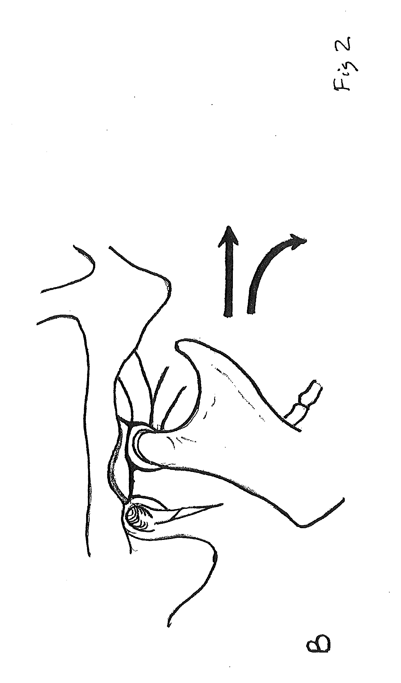 Apparatus and method for airway patency and head immobilization