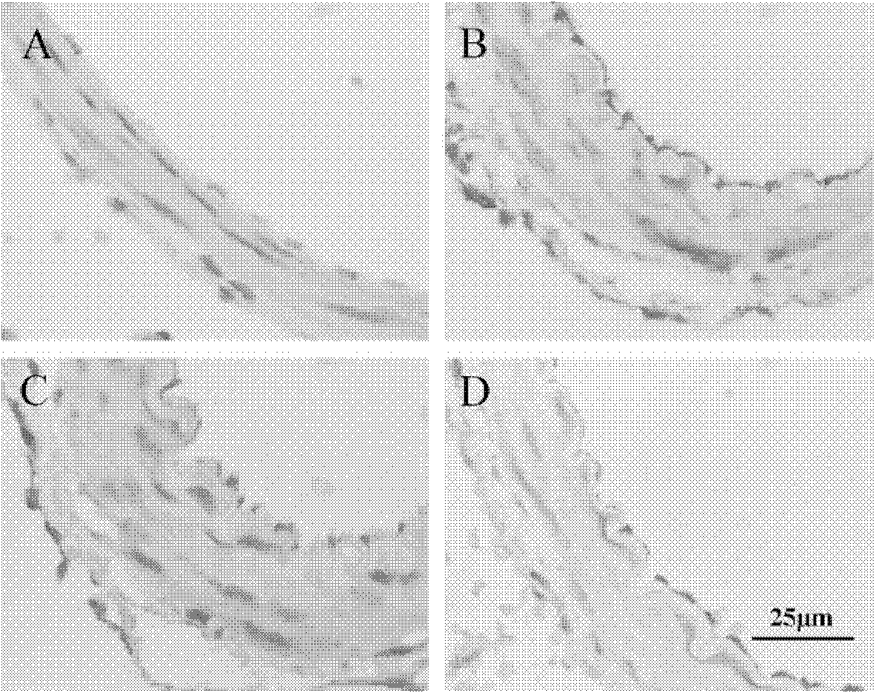 Application of sorafenib to treatment of cerebral vasospasm (CVS) after subarachnoid hemorrhage (SAH)