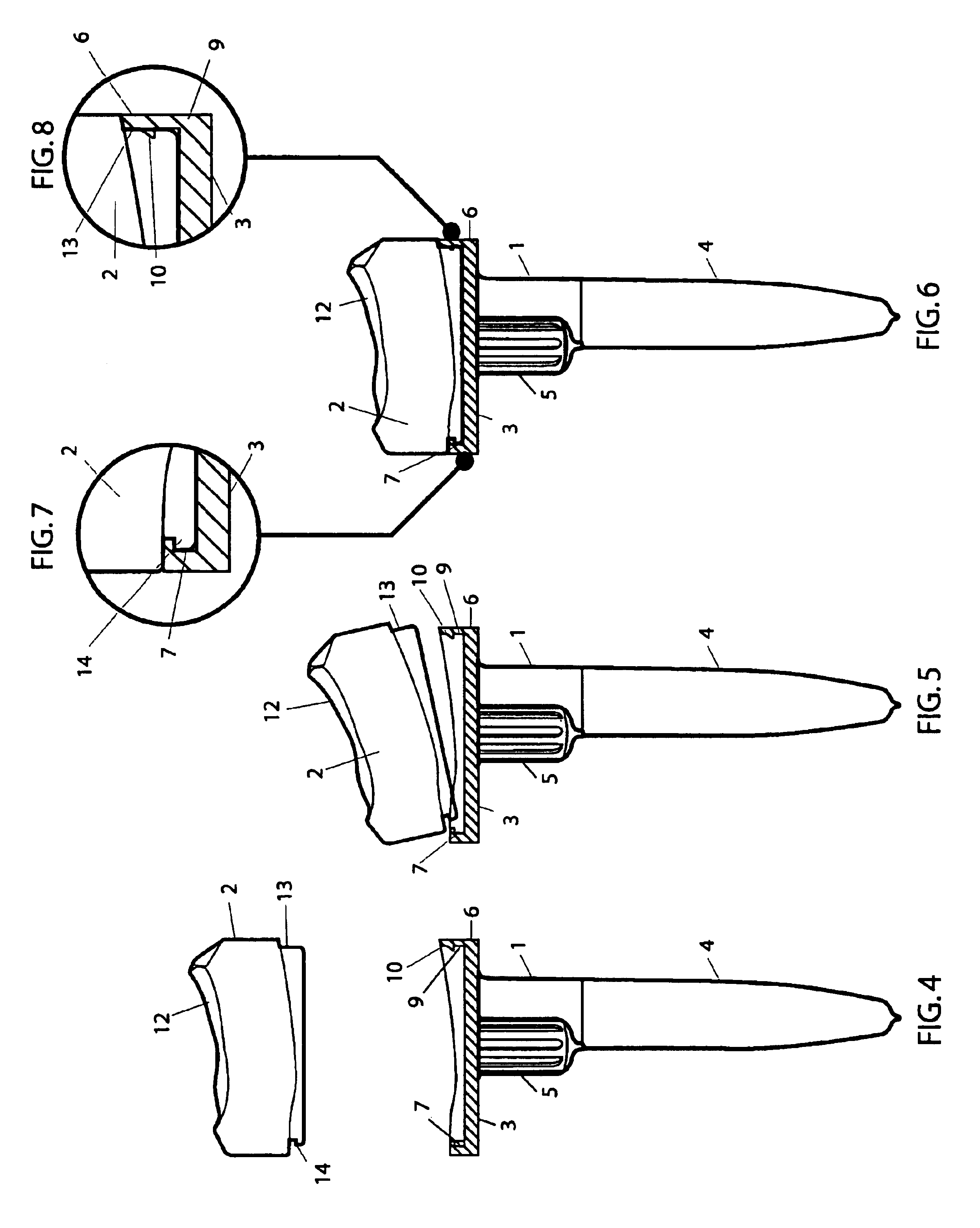 Prosthesis