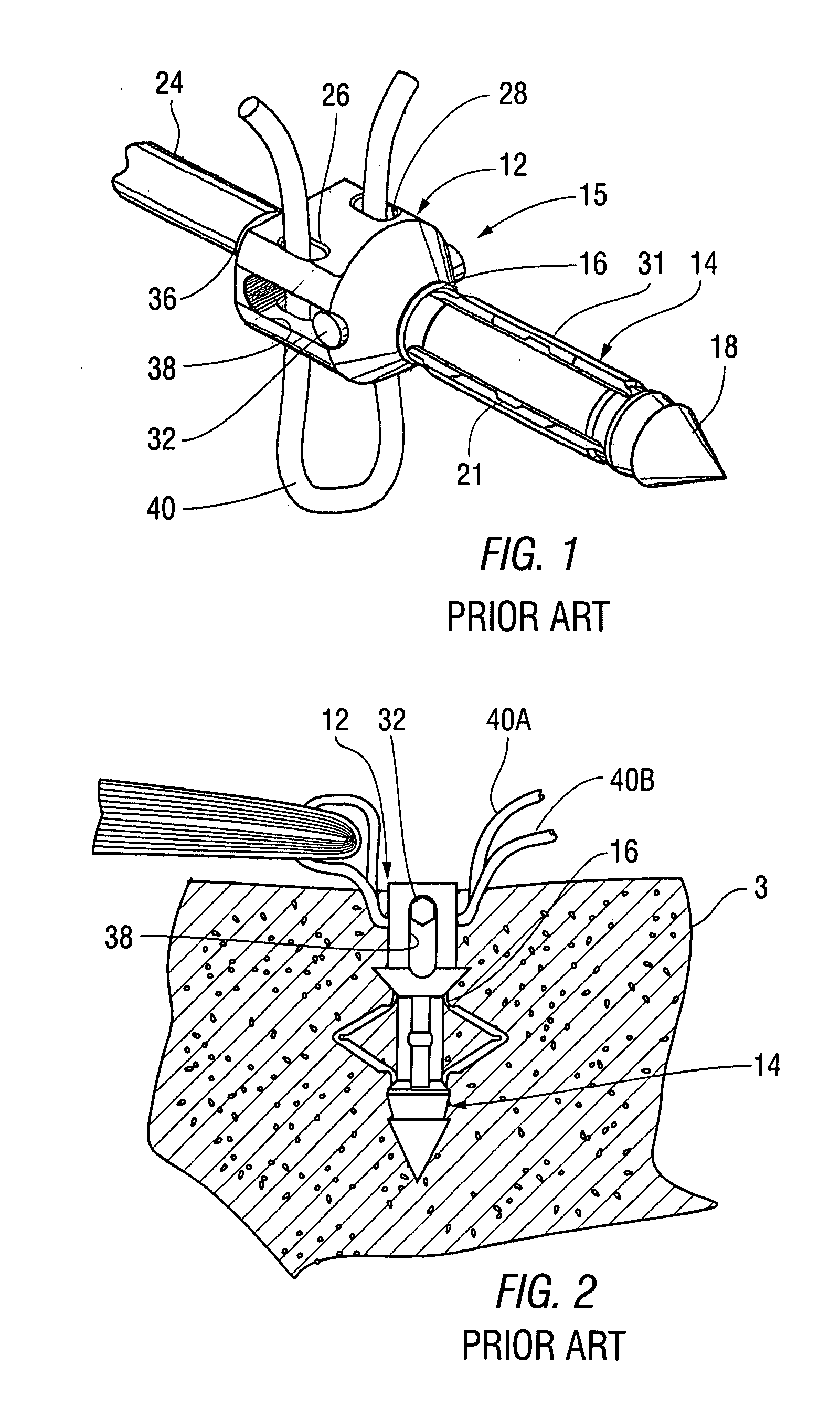 Knotless suture anchor and receptacle combination