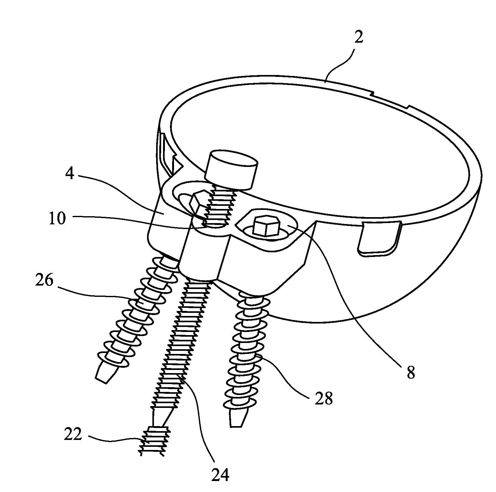 Cup component of an orthopaedic joint prosthesis