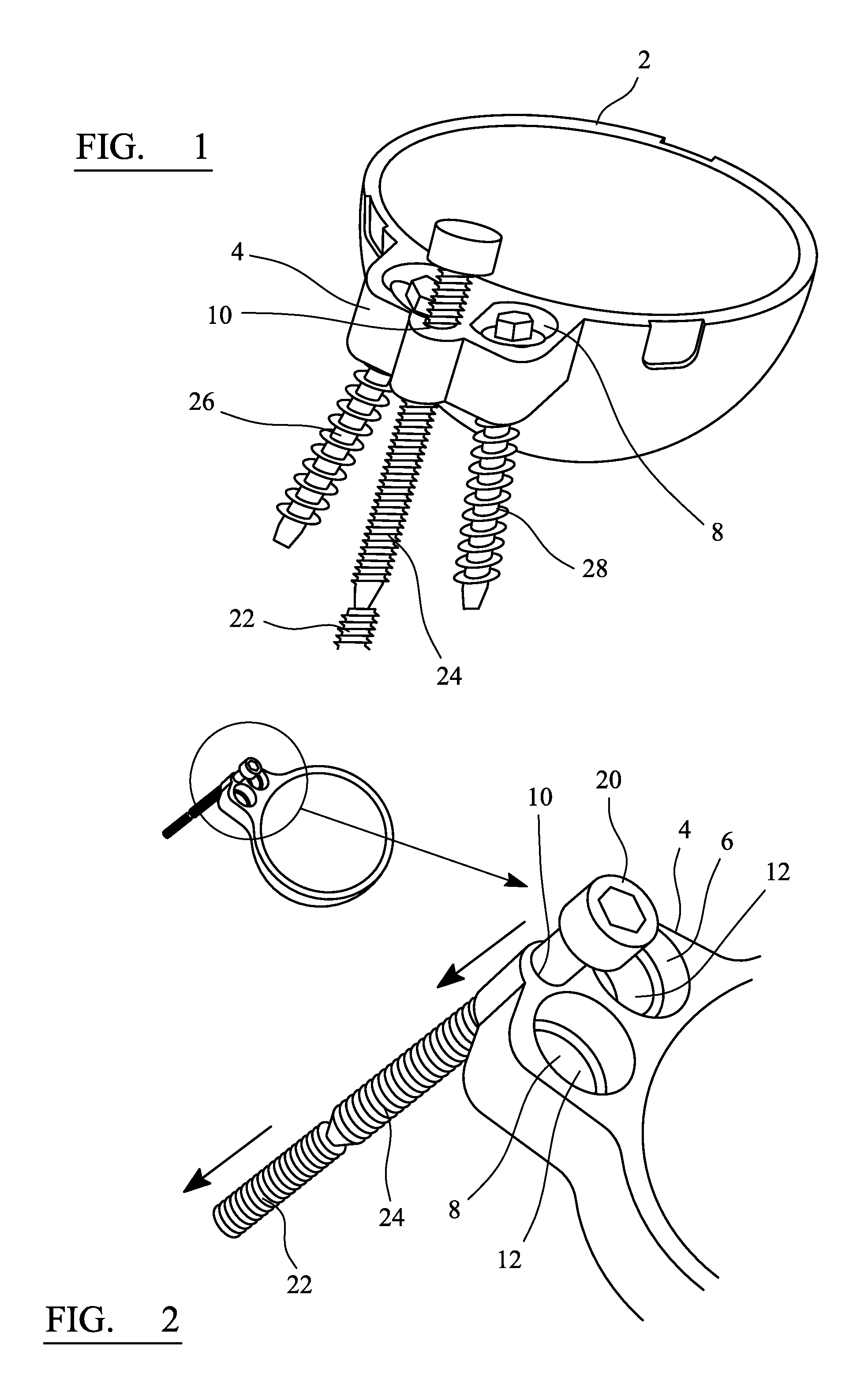 Cup component of an orthopaedic joint prosthesis