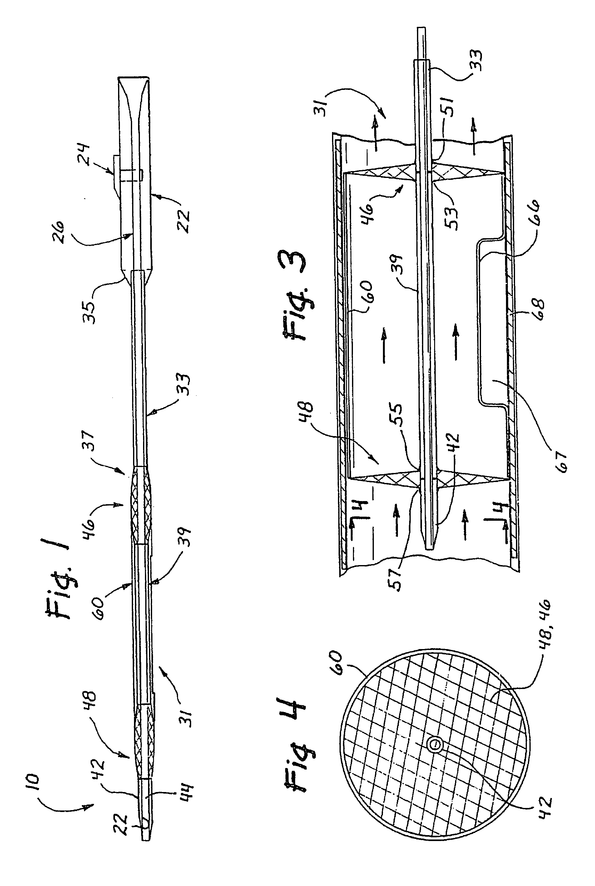 Vascular exclusion catheter