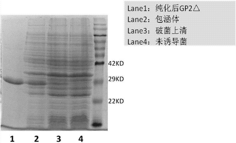 Antigen fragment and truncated protamine based on Marburg virus envelope protein and application