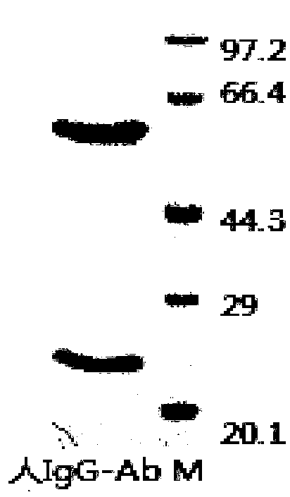 Anti-human IgG monoclonal antibody, hybridoma cell line and application thereof