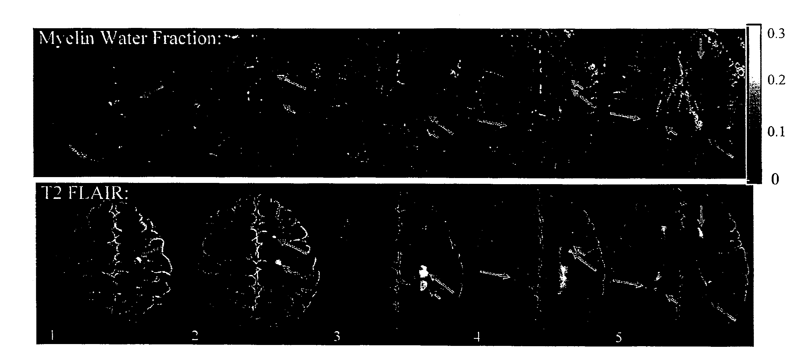 Method for fast multi-slice mapping of myelin water fraction