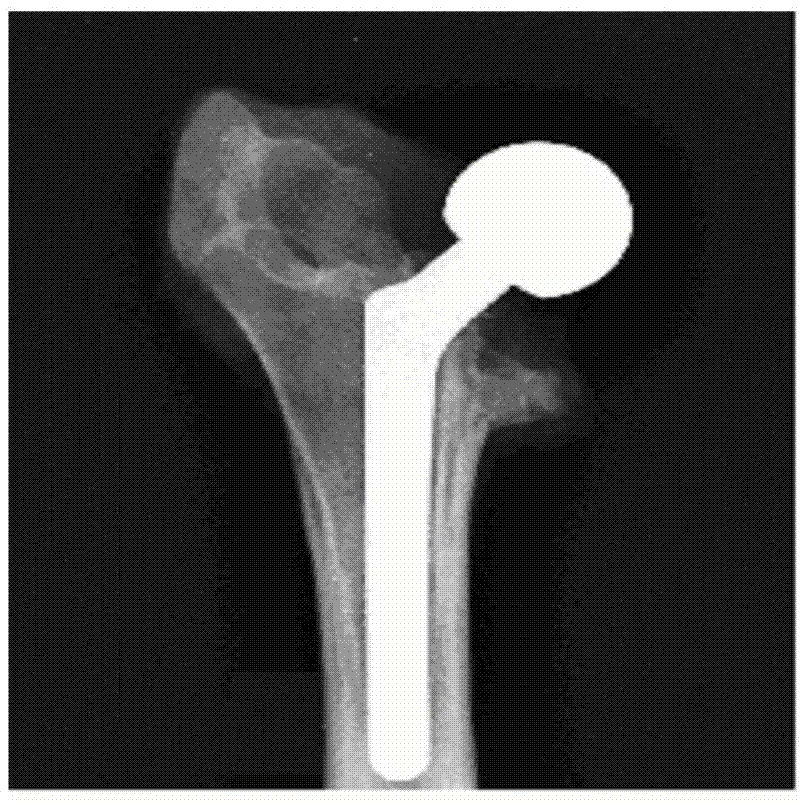 Method for strengthening joint stability by using rhBMP-2 release coating on surface of artificial joint