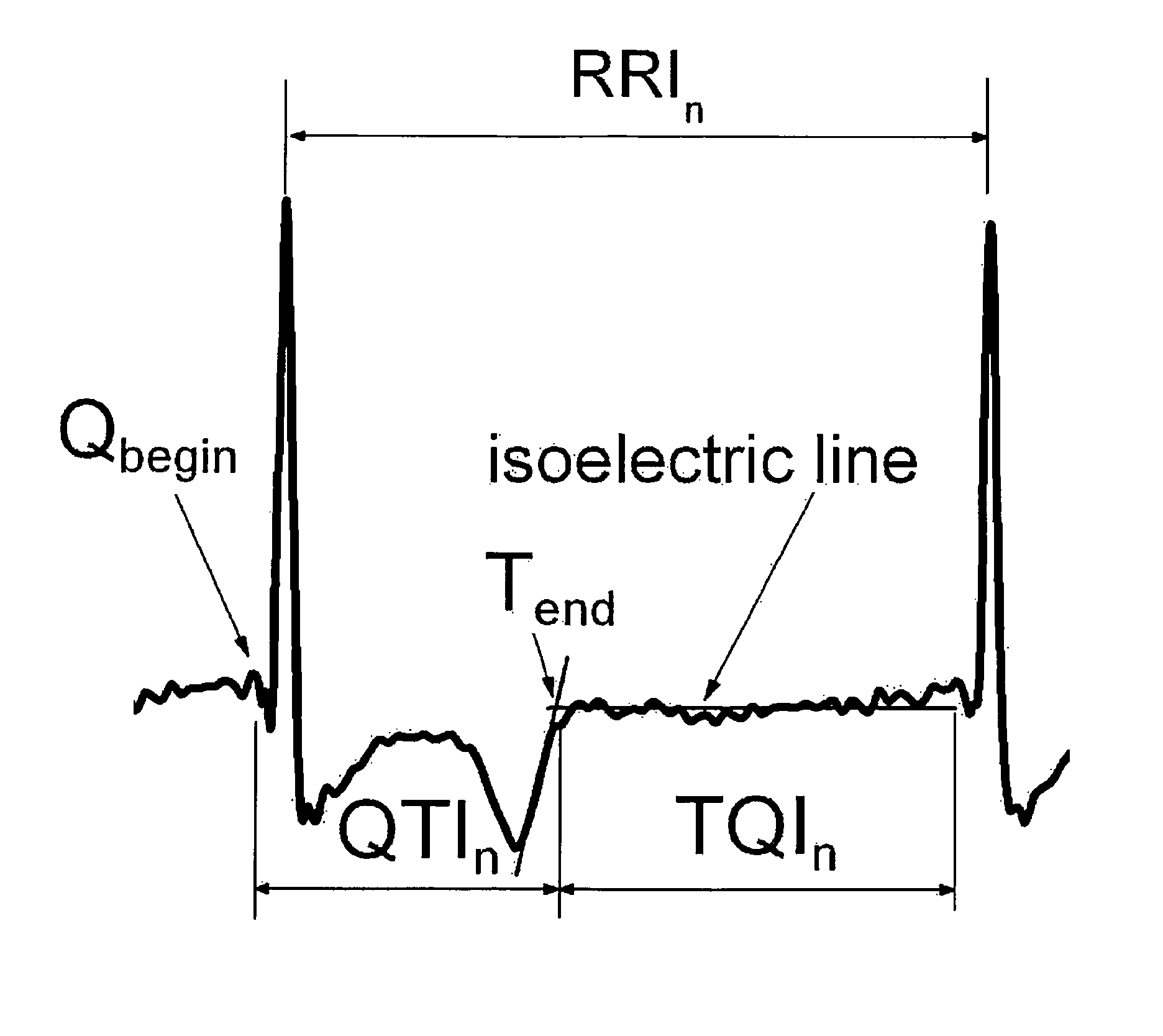 Methodology for arrhythmia risk stratification by assessing QT interval instability