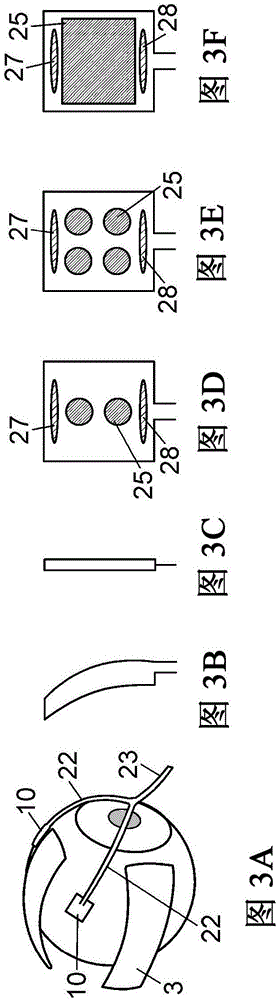 A device for a medical treatment of a sclera