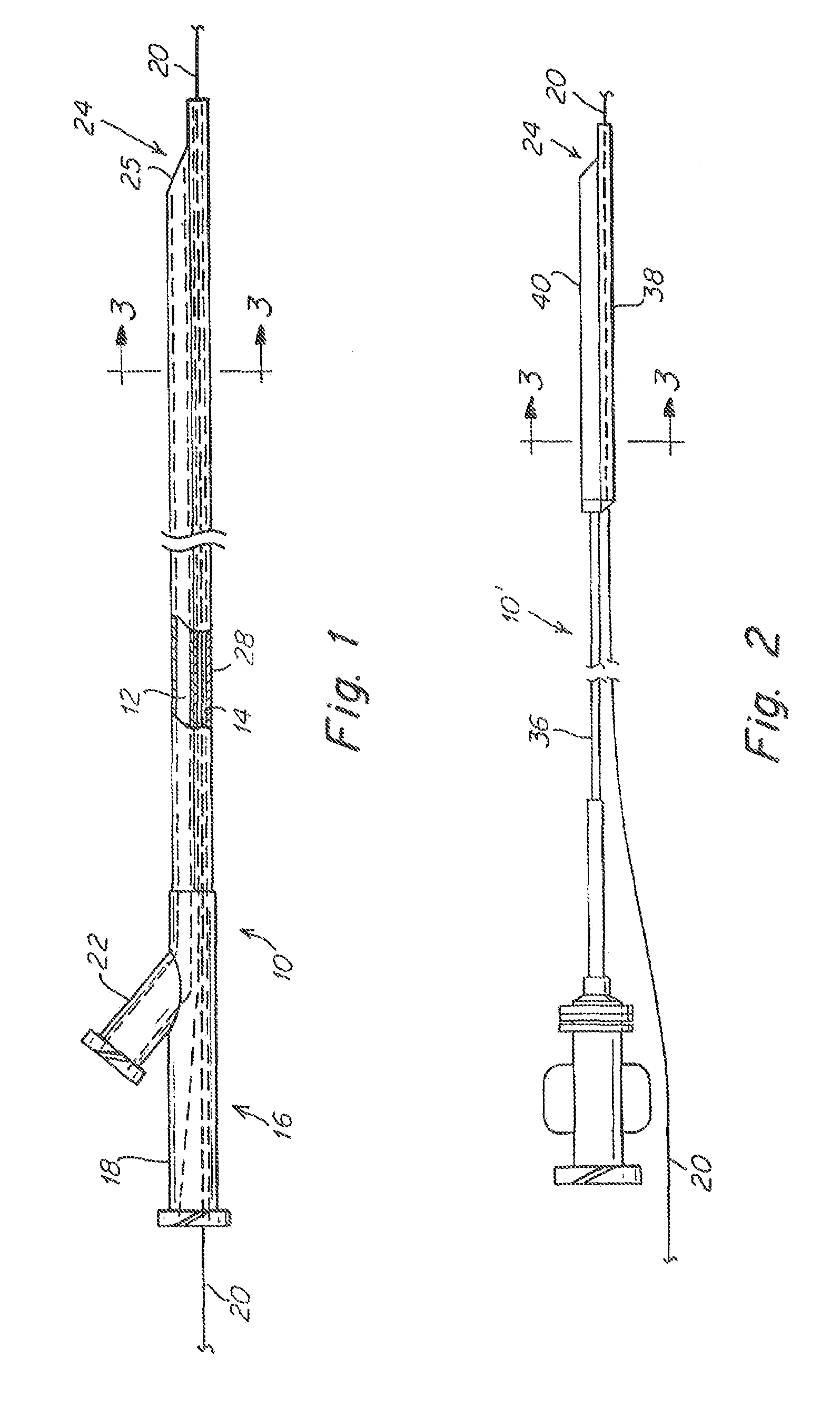 Aspiration Catheter Having Variable Volume Distal Suction Chamber