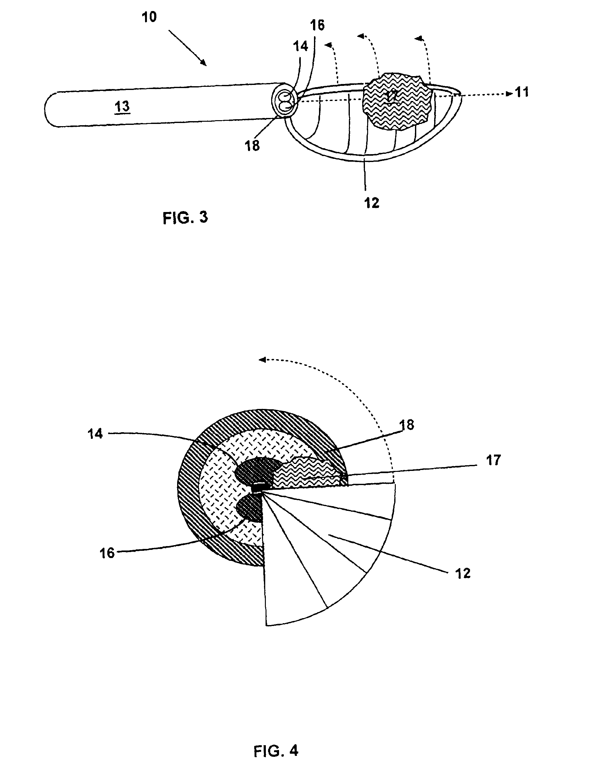 Methods and devices for the in situ dissolution of renal calculi