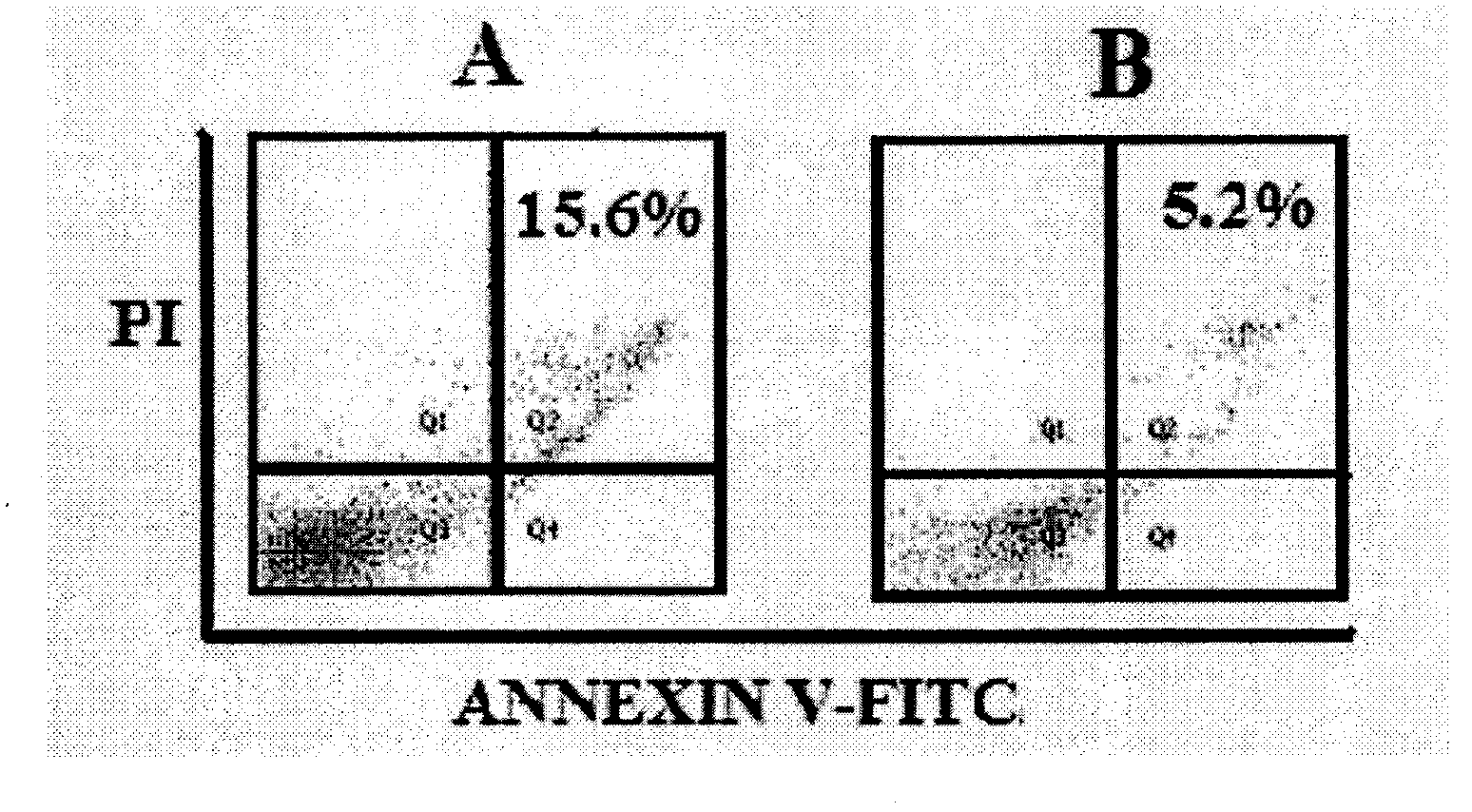 Microcarrier culture system of umbilical cord mesenchymal stem cells