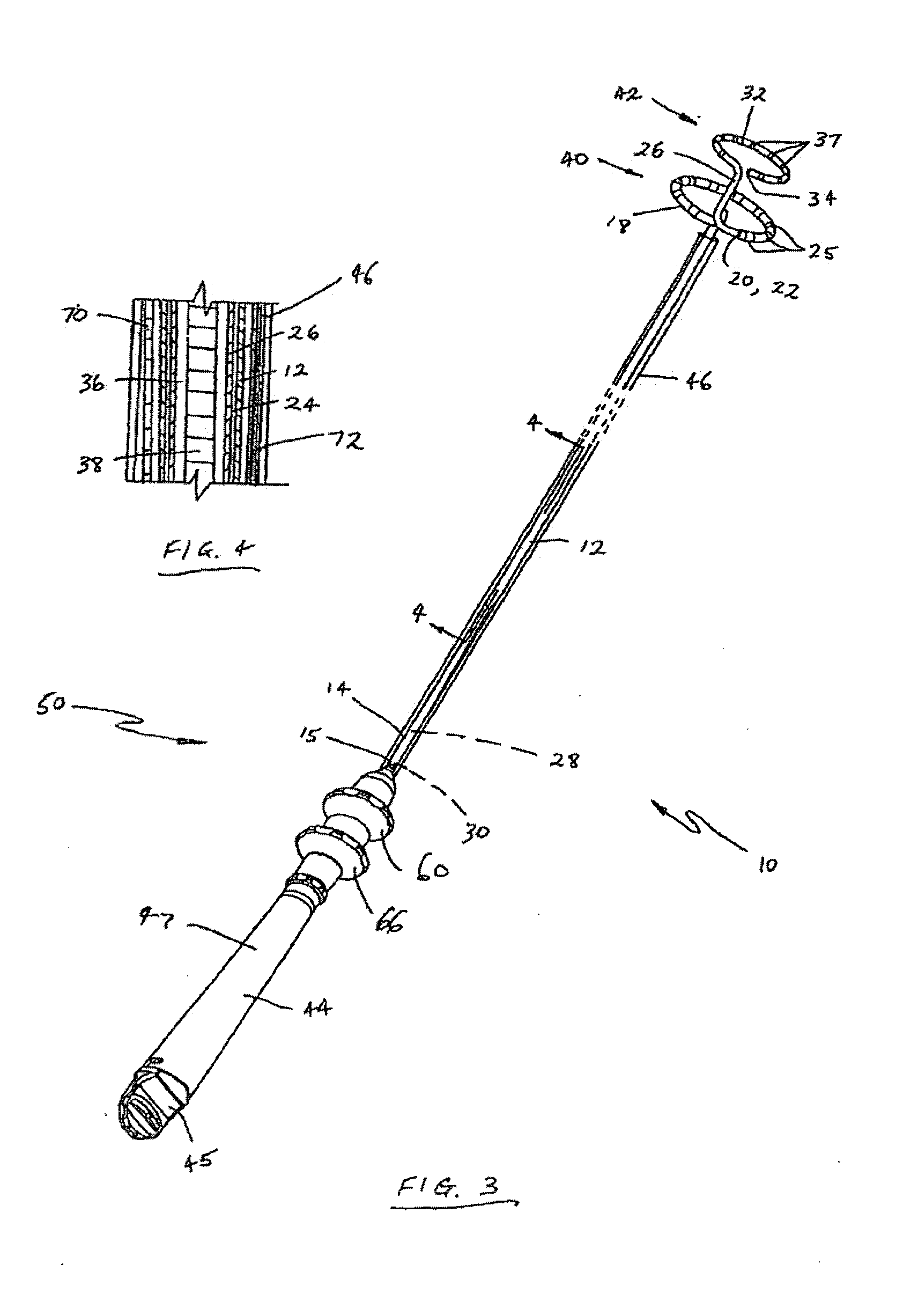 Catheter assembly