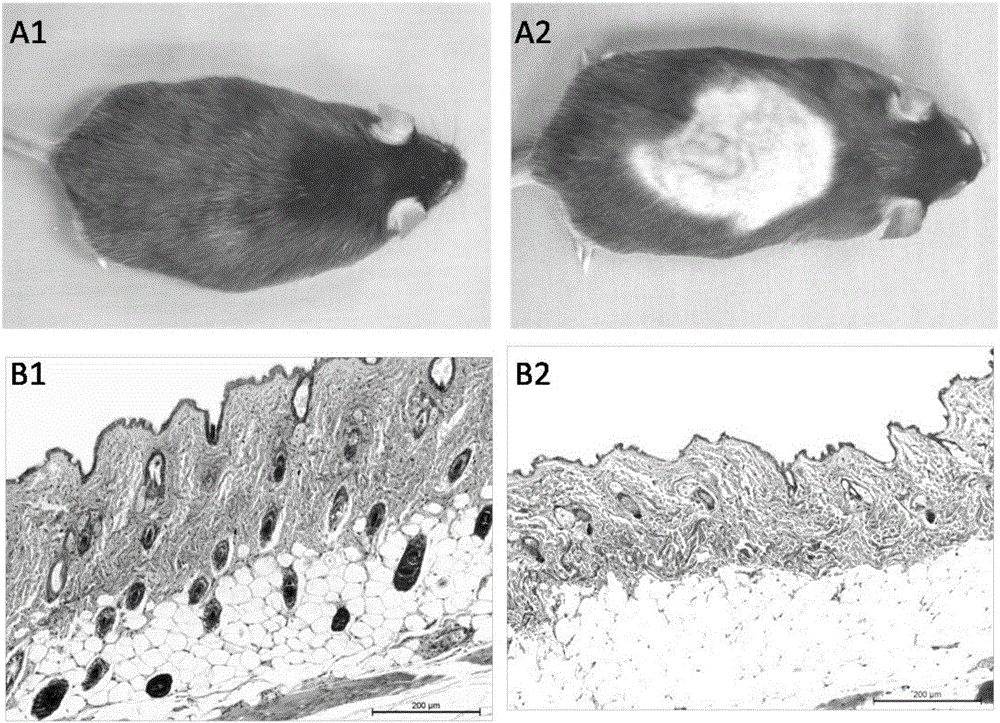 Hair regeneration method for mesenchymal stem cell-induced alopecia areata and application