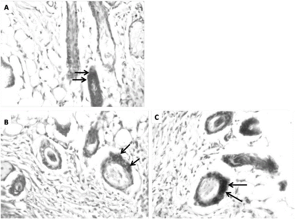 Hair regeneration method for mesenchymal stem cell-induced alopecia areata and application