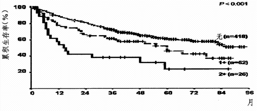 Single nucleotide polymorphism for prognosis of hepatocellular carcinoma