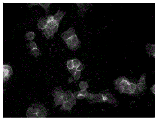 Application of toremifene citrate in the preparation of drugs for inhibiting tumor cell metastasis and spread